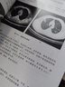 包邮 MRI诊断报告书写技巧+X线+CT诊断报告书写技巧 3册 影像报告书写一点通系列 实拍图