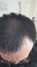 超人（SID） 超人剃头理发器电推剪电动电推子剪发器成人儿童婴儿剃头刀家用套装RC520套装 标配赠超维8805毛球修剪器 实拍图
