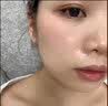 韩伦美羽 微晶法令纹贴提拉紧致淡化法令纹八字嘴角胶原面膜贴改善松弛 一盒（5对）体验装 实拍图
