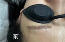 TANZI璀璨810多功能洗脱一体机小型拉杆箱黑科技洗眉机大功率美容院用 【810/双手柄】洗脱一体/黑色/六头 实拍图