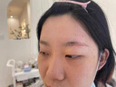 TANZI璀璨810多功能洗脱一体机小型拉杆箱黑科技洗眉机大功率美容院用 【810/双手柄】洗脱一体/黑色/六头 实拍图