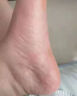 秋雅奈绪正品手脚裂膏脚后跟干裂开裂专用膏药真菌脱皮干燥手足皲裂龟裂膏 买3送2【只限今日】特效五盒 冬天干裂起硬皮开裂足跟皮肤粗糙感染防裂滋润膏 实拍图