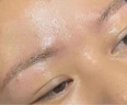 TANZI璀璨810多功能洗脱一体机小型拉杆箱黑科技洗眉机大功率美容院用 【810/双手柄】洗脱一体/黑色/五头 实拍图