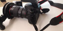 佳能（Canon）新百微镜头EF 100mm f/2.8L IS USM微距镜头 口腔牙科专用 全画幅单反相机定焦镜头 EF100mmf2.8 IS USM新百威镜头 实拍图