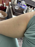 修正静脉曲张弹力袜子夏季薄款辅助医用治疗型男女士二级贴身压力袜减压裤小腿袜防血栓水肿疼痛可搭冷敷凝胶 2级中筒 肤色露踝 XL 实拍图