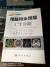 颅脑和头颈部CT诊断 实拍图