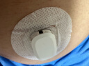 微泰动泰 动态血糖测试仪家用14天连续测血糖仪器免扫描免校准传感器探头(老客2个月测糖包) 实拍图