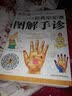 有病早知道：图解手诊 零基础学手诊手诊中医入门零基础学中医诊断中医书籍大全医书籍大全中医中医基础理论 实拍图
