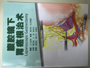 腹腔镜下胃癌根治术(翻译版) 实拍图