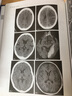 神经系统CT与MRI影像解读 实拍图
