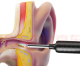 bebird 智能可视挖耳勺镊子掏耳朵工具采耳内窥镜 Note3 Pro Max 星耀蓝 实拍图