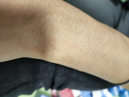 两张图，正常刮掉是这种的，第一次用，不知道纸擦掉就可以了，第二张就是用纸擦掉的样子，感觉还是挺干净的，只试用了一小片区域，很温和，一点刺激感也没有，味道也挺好闻的，香香的，没有刺鼻的气味，涂的时候稍微涂厚点，时间到了直接用纸巾擦掉就好，操作简单