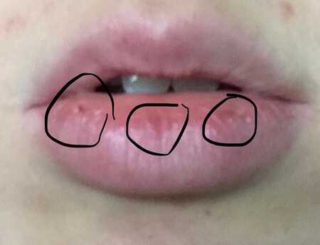 脱皮，抹了之后脱皮。还不给退货。口红里面亮晶晶的，闪光，擦了之后嘴特别丑特别大。第一次给差评，真好。