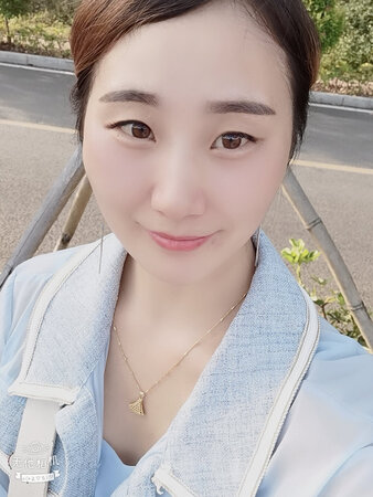 效果很好 白了不止一个度  客服服务也满分