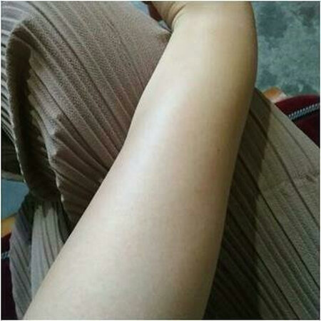挺舒服的，周围皮肤变得光光滑滑的很滋润。没有汗毛之后都显白了很多.