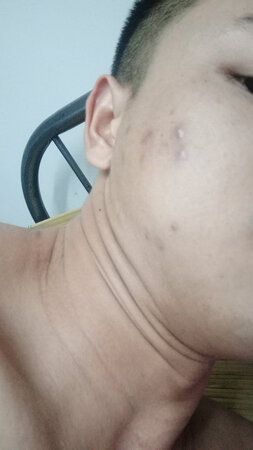 #商家，用完之后是这样的，我要赔偿！本来好好的一张脸，#