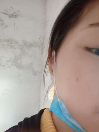 太差劲了，用了一次就过敏，我后悔死了，一脸的痘痘