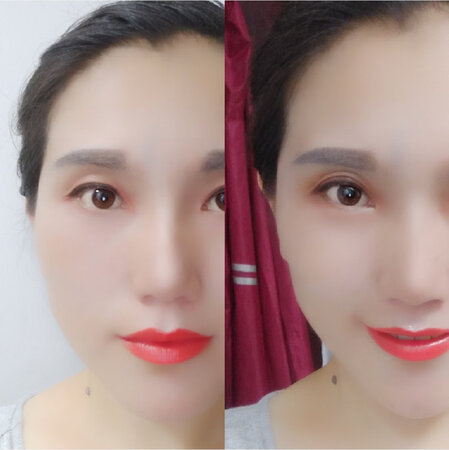 我本身就是双眼皮，时光流逝，眼周肌肤皮肤略松，双眼皮没有没那么宽了，这款眼胶非常好用，轻轻一抹等到干了一推就好，特别方便还便宜