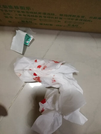 质量不行。钢管边角锋利。付出了血的代价。然后客服还只是说了一声抱歉而已。更加差评