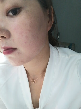 使用感受：一般，
适合肤质：不适合
吸收效果：很快
保湿效果：不怎么保湿
其他特色：过敏，