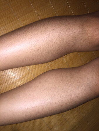 脱毛很快 就是量少 有黑点
