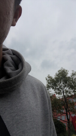 脸上越擦越多 皮肤还不好 真的烂
