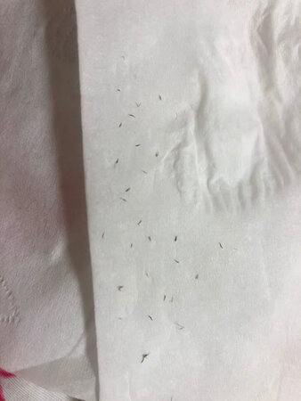 超级无敌赞，不得不说这个太好用了，平常就喜欢用指甲去抠，又疼又不卫生，这个我只轻轻的用斜夹-夹就很轻松的夹了出来，一点都不觉得痛,夹子完美的贴合,太实用了，图片是用夹子夹出来的黑头,我喜欢用那个斜的夹子，弯脚的夹子用不习惯,总夹到肉, 也不知道什么情况，黑头贴贴完撕下来的时候很疼呀,消毒的酒精棉球挺方便实用的。