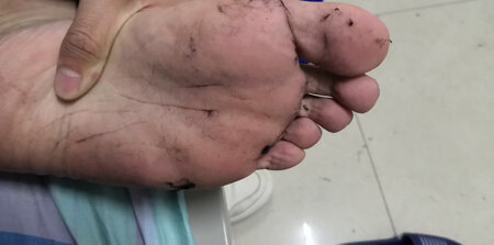 穿着还行，就是脱毛