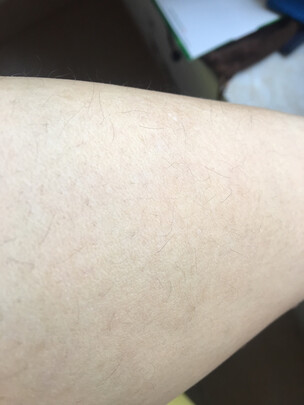 达人评飞利浦脱毛仪能永久脱毛吗？真的有人被骗了吗！