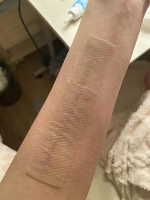 疤痕贴