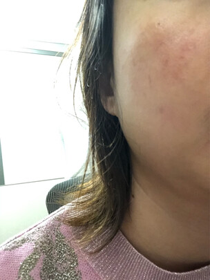 美容仪|美杜莎美杜莎美容仪器好吗？图文评测曝光