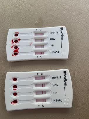 三,万孚(wondfo)艾滋病试纸网友对比评测