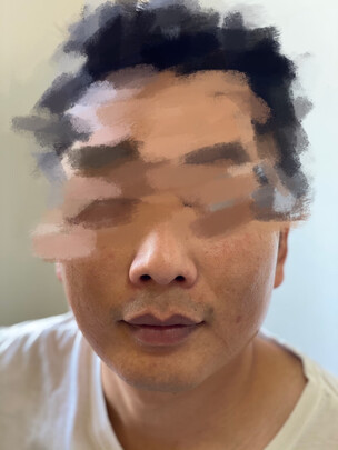 Tripollar|Tripollar Intelligent Biologystop vx美容仪怎么样？亲身体验告知你实情！