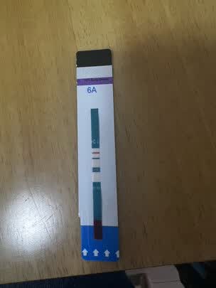 三,万孚(wondfo)艾滋病试纸网友对比评测