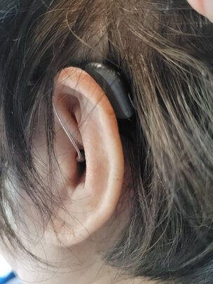 %title插图%num 【飞MI电子凭证】飞利浦(PHILIPS)助听器重度隐形耳聋耳背式大功率儿童年轻老年人专用 【门店提货】米5PR(60/85/100)+大礼包