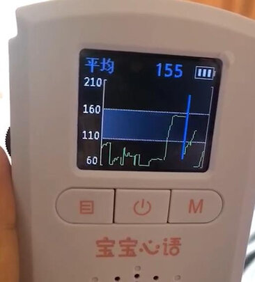 胎心仪