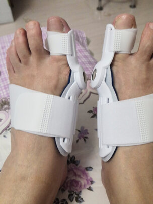 脚趾矫正器