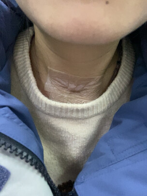 疤痕贴