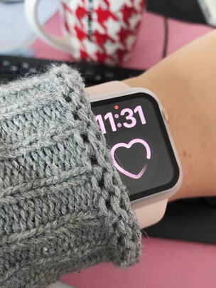 AppleApple Watch SE（前车之鉴）有必要告诉大家真相