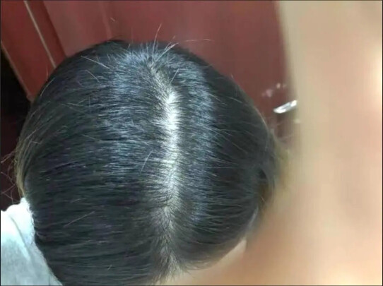 北京同仁堂洗发水防脱怎么样质量很烂是真的吗