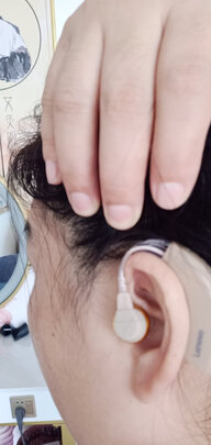 助听器