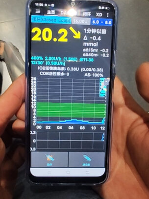 %title插图%num 【丹纳旗舰店】丹纳R泵胰岛素泵全自动智能家用带无线遥控注射器搭建闭环半闭环韩国DANA-R血糖注射泵 【下单立减】R泵+22套耗材+上门安装+动态血糖仪