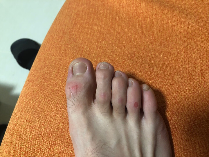 鞋子太磨脚,打了40分钟脚磨破皮了,球鞋不能穿着打球买来干啥呀