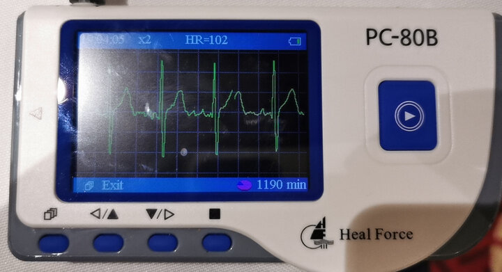 力康pc-80b:"十分好用,简单易懂上手两分钟就学会看ecg电轴了可以用手