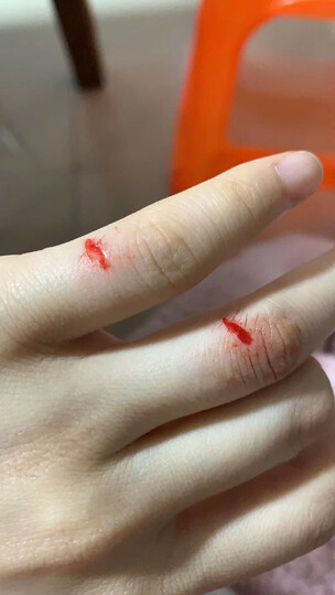 长寿泉:"做工粗糙,拆装时轮椅下铁片划伤手多处,轮为非钢丝,属塑料