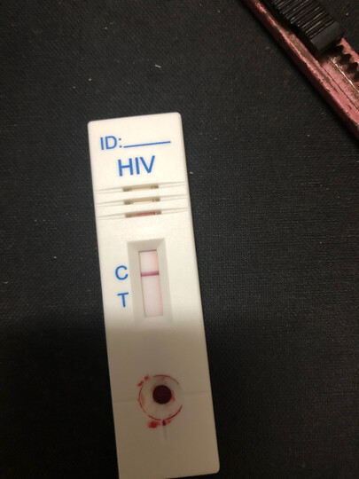 准信hiv检测试纸:"其实我不算高危,因为去年10月跟一个感染者吃了一顿