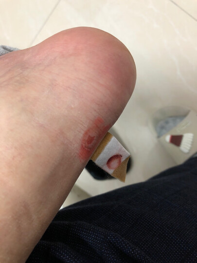 穿了1天,后脚跟被磨破皮,这么贵的鞋--想不通!