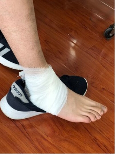 优诺康:"老公打球的时候把脚摔伤了,走路很不方便,医生建议买一个这个