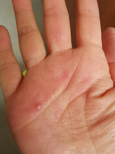 就是安装费力,手都磨出水泡了.