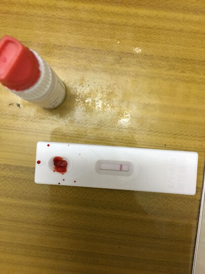 dpp艾滋病检测试纸 hiv抗体检测试剂 血液检测 技术可靠看那个血 真让